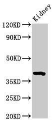 Anti-Wnt3