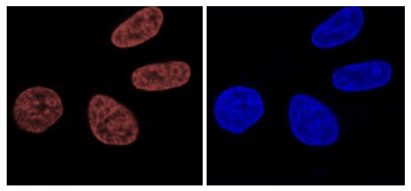 Anti-phospho-Histone H2A.X (Ser139)