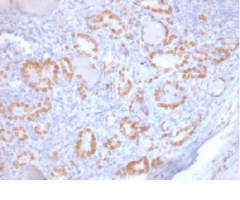 Anti-TTF-1 / NKX2.1 (Thyroid &amp; Lung Epithelial Marker) Recombinant Mouse Monoclonal Antibody (clone: