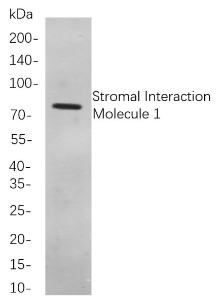 Anti-Recombinant Stromal Interaction Molecule 1, clone 11B8