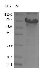 Cytochrome P450 11B2, mitochondrial (CYP11B2), human, recombinant