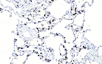Anti-SFTPC / Surfactant protein C