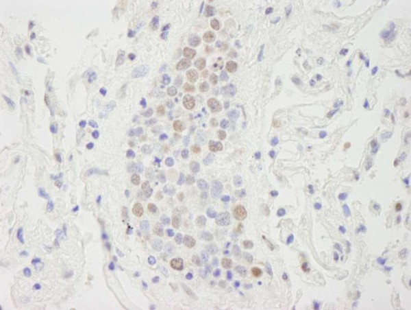 Anti-SUPT6H (IHC)