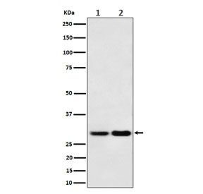 Anti-MTAP / MTA phosphorylase, clone 28M98