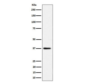 Anti-MRPS31 / Small ribosomal subunit protein mS31 / Imogen 38, clone 29M40