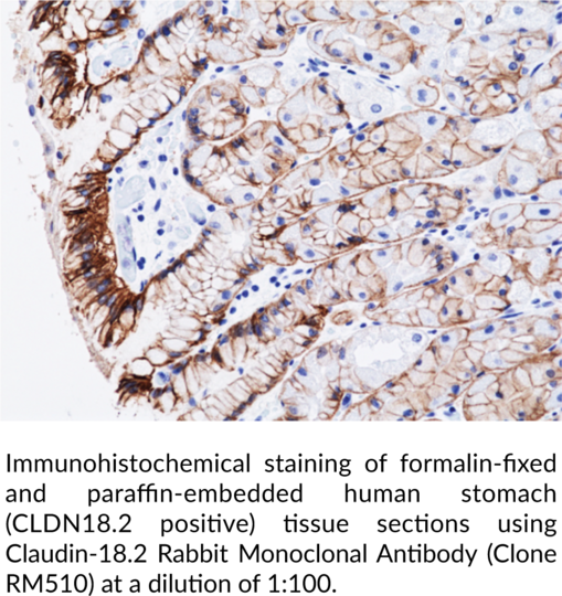 Anti-Claudin-18.2 Rabbit (Clone RM510)