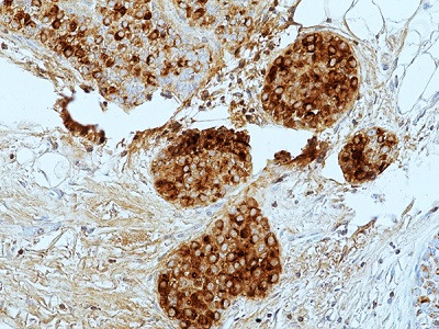 Anti-GCDFP-15 (human), Rabbit Monoclonal (RM504)