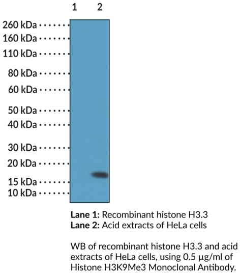 Anti-Histone H3K9Me3 Monoclonal Antibody (RM389)
