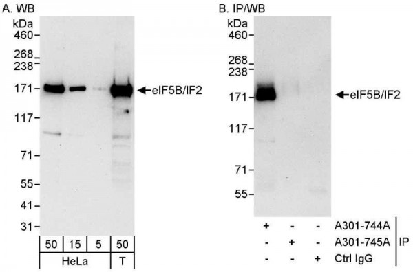 Anti-eIF5B/IF2