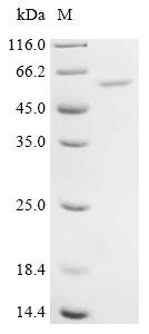 Synaptic vesicle membrane protein VAT-1 homolog-like (VAT1L), recombinant human