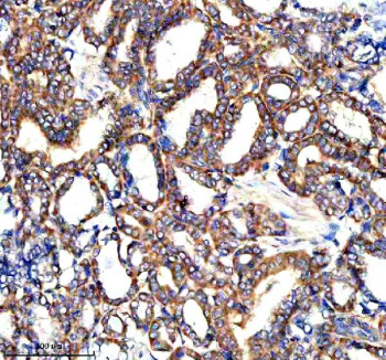 Anti-PARP16 / Poly ADP-ribose polymerase 16