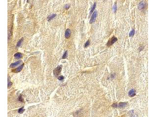 Anti-ECSIT (Evolutionarily Conserved Signaling Intermediate in Toll Pathways)