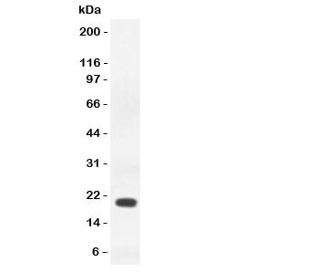 Anti-IFN gamma