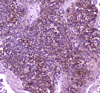 Anti-PLC gamma 2