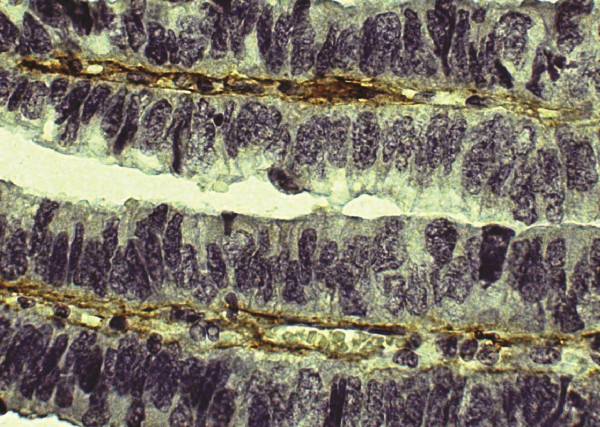 Anti-Collagen V