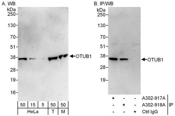 Anti-OTUB1