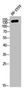 Anti-COL4A2