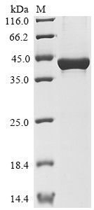 Carboxypeptidase N catalytic chain (CPN1), partial, human, recombinant
