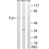 Anti-FYN (Ab-530)