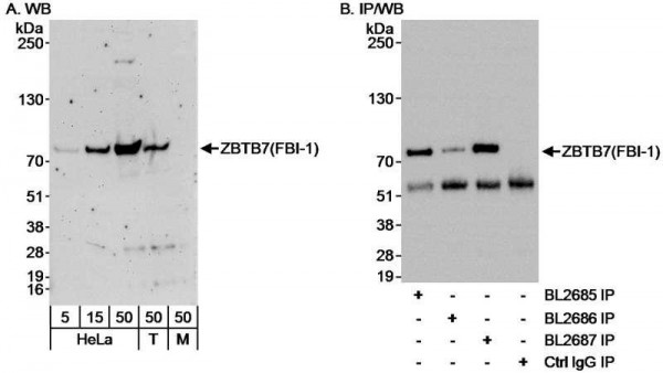 Anti-ZBTB7/FBI-1