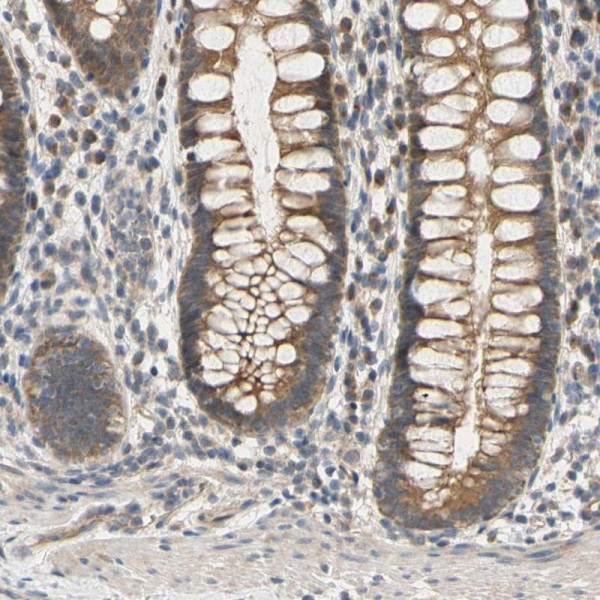 Anti-MBTPS2