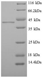 ELAV-like protein 2 (ELAVL2), partial, human, recombinant
