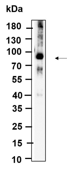 Anti-Recombinant ALDH16A1, clone 3G2