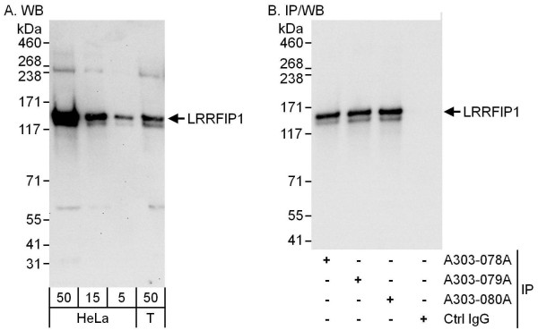 Anti-LRRFIP1