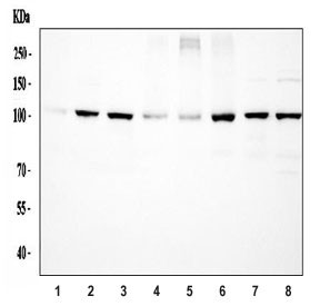 Anti-ACTN4 / Alpha Actinin 4