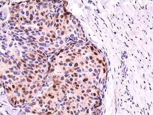 Anti-Cyclin D1 (human), Rabbit Monoclonal (RM241)