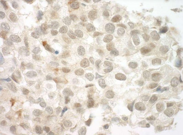 Anti-PRCC (IHC)