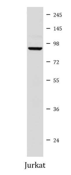 Anti-Prolactin Receptor