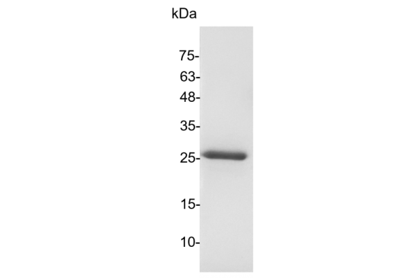 SUMO-Specific Protease 2 (SENP2)