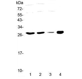 Anti-APOBEC3A / PHO1 / Phorbolin 1