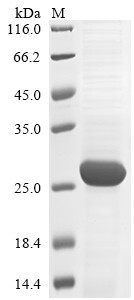 Retinoblastoma-like protein 2 (RBL2), partial, human, recombinant
