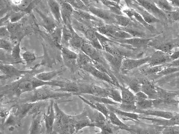 ImWilms10T Cells