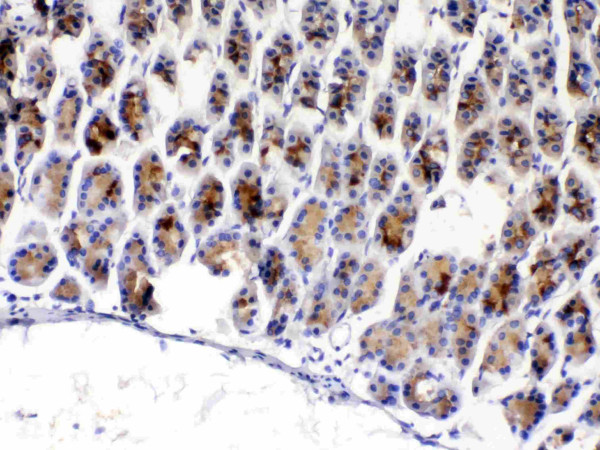 Anti-TFF3 / Trefoil factor 3
