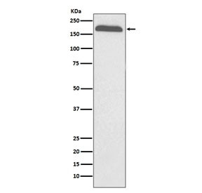 Anti-Alpha-2-macroglobulin / A2M, clone ABAO-1