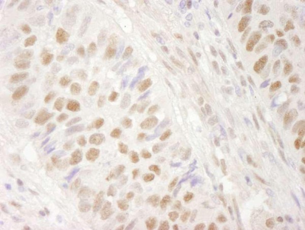 Anti-BRG1/SMARCA4 (IHC)