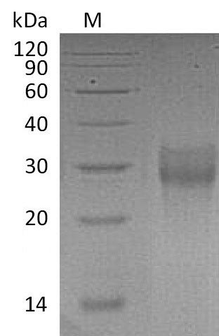 Tumor necrosis factor receptor superfamily member 9 (TNFRSF9), partial (Active), human, recombinant