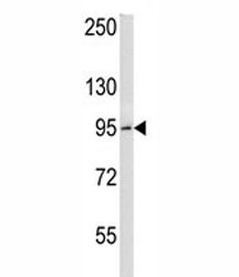 Anti-BCL6