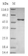 Ras-related protein Ral-B (RALB), human, recombinant