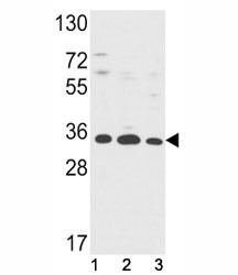 Anti-Annexin V