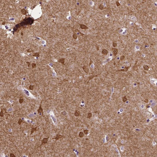 Anti-PTPN5