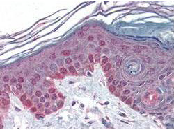 Anti-Cyclin-T1