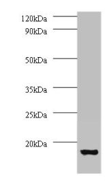 Anti-ATP6V1G1