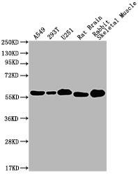 Anti-PKM Monoclonal, clone 6C3C7