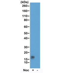 Anti-phospho-Histone H3 (Thr11), clone RM164 (recombinant antibody)