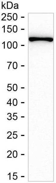 Anti-FAK (recombinant antibody)