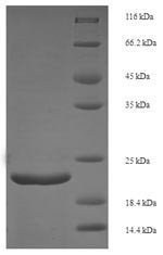 Fibroblast growth factor 21 (Fgf21), mouse, recombinant